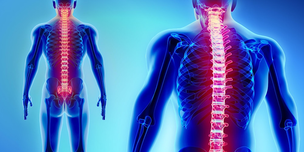 Metastatic Spinal Cord  Compression Study Day