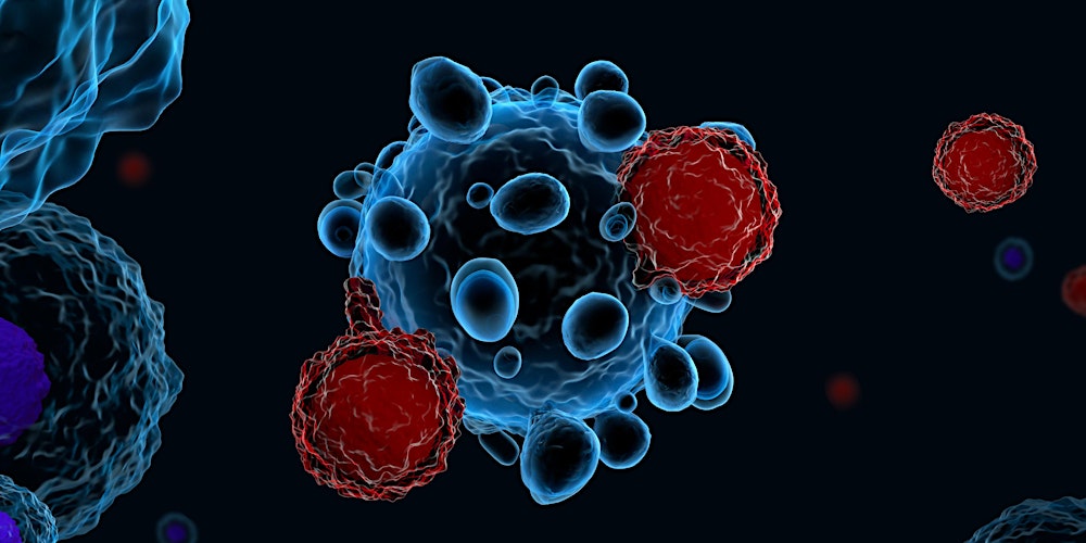 Unlocking TIL Therapy: A New Era for Melanoma Care in the UK