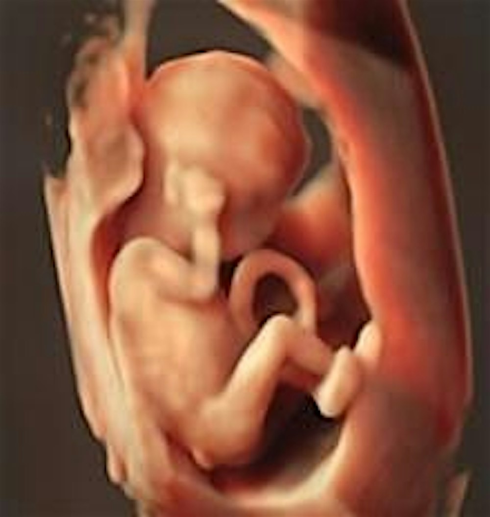 Fetal Ultrasound: From first trimester to advanced fetal anomalies
