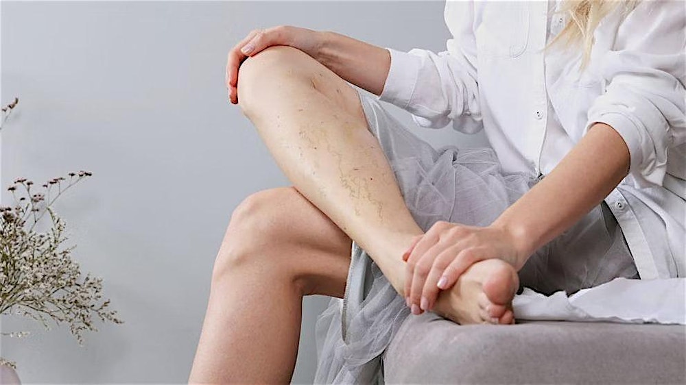 Sclerotherapy for Physicians & Nurses - Nashville, TN