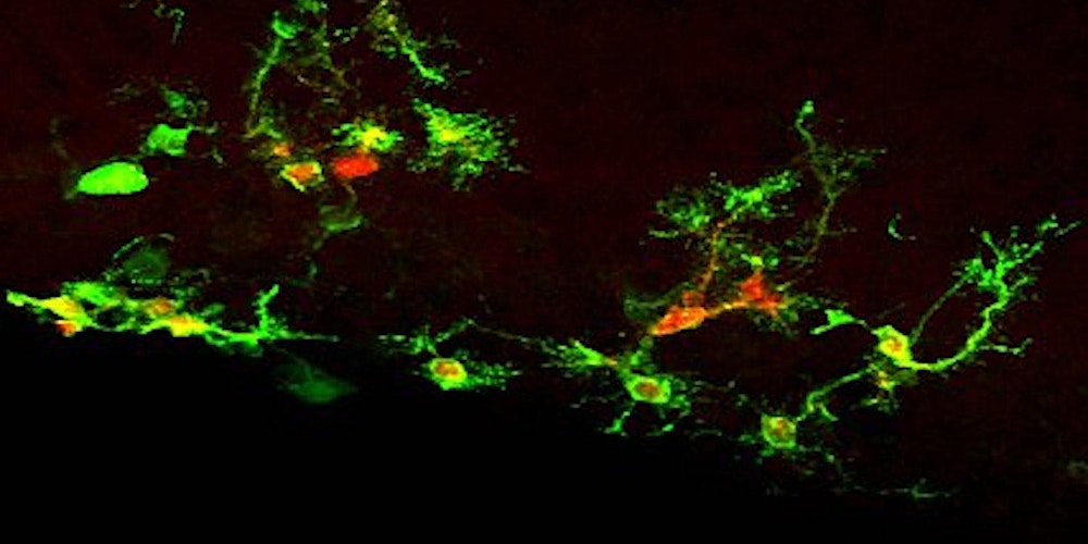 Stem Cells and Brain Development