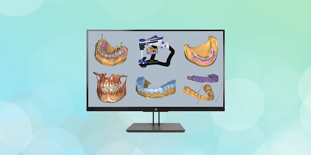 All on X: Where Digital & Analog Meet