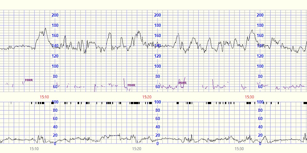 Mater Hospital FSEP Training Day